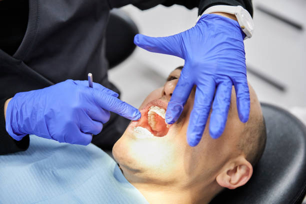 Best Emergency Tooth Extraction in Rockdale, TX
