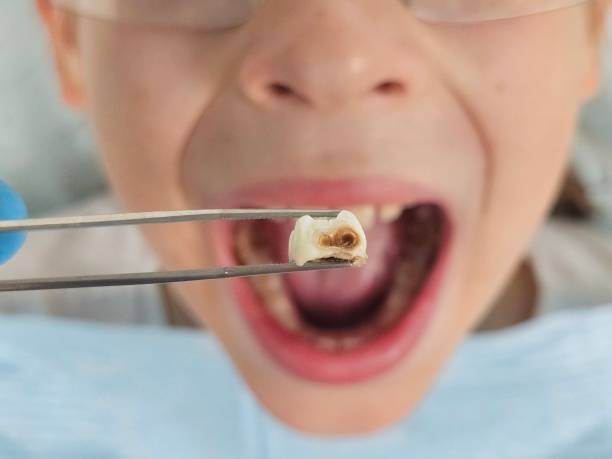 Best Same-Day Emergency Dentist in Rockdale, TX