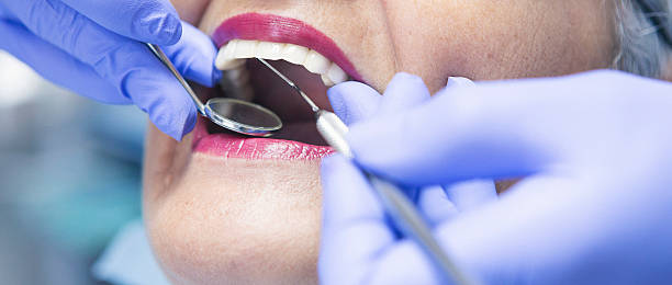 Best Emergency Treatment for Toothache in Rockdale, TX